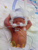baby chloe in nicu