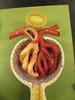 Kidney Model 4